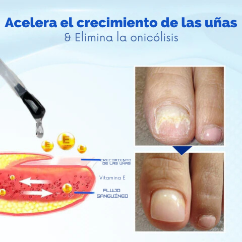 ONYXOGUARD SERUM UÑAS P1