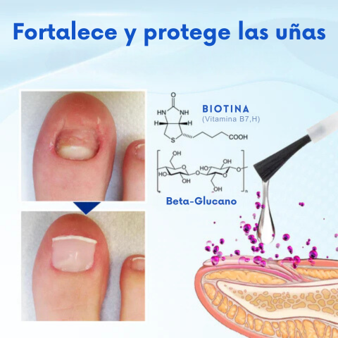 ONYXOGUARD SERUM UÑAS P1