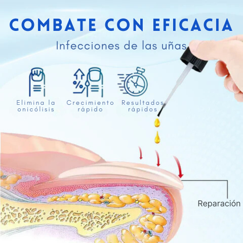 ONYXOGUARD SERUM UÑAS P1